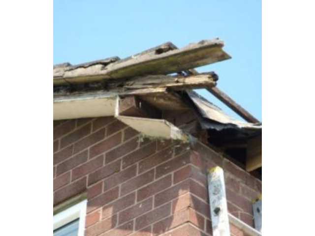 Fascia before Fascia before